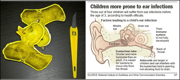 ear_infection